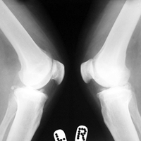 Arthroscopy Surgeon in Ahmedabad