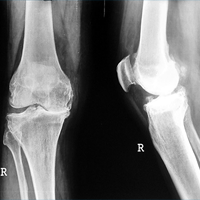 Arthroscopy Surgeon in Ahmedabad