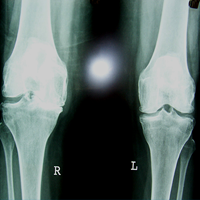 Arthroscopy Surgeon in Ahmedabad