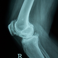 Arthroscopy Surgeon in Ahmedabad