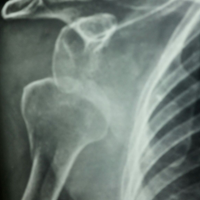 Limb Reconstruction Doctor|Sports Injuries Doctor