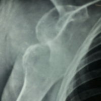 Spine Treatment In Jaipur|Best Trauma Surgeon in Ahmedbad