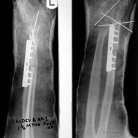 Rehablition Doctor In Ahmedabad