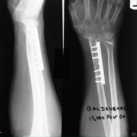 Spine Treatment In Jaipur|Sports Injuries Doctor