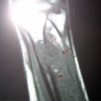 Best Orthopedic Surgeon In Satellite|Orthopedic Oncology Doctor