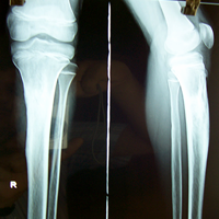 Spine Best doctor in satellite|Best Orthopedic Surgeon