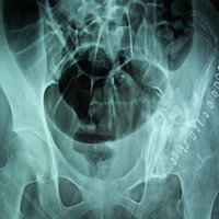 Best spine surgeon in ahmedabad|Best Trauma Surgeon