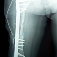 Sports Injuries Doctor