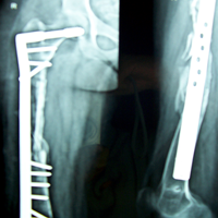 Best Trauma Surgeon in Ahmedbad