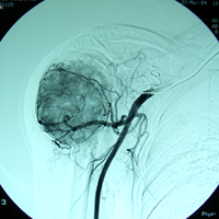 Limb Reconstruction Doctor