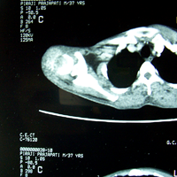 Sports Injuries Doctor