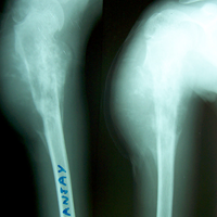 Spine Surgeon Best In Rajasthan