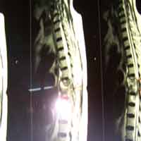 Best Orthopedic Surgeon In Satellite|Sports Injuries Doctor