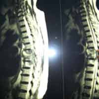 Orthopedic Oncology Doctor In Ahmedabad|Trauma Surgeon in Ahmedabad